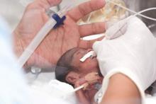 Premature Baby