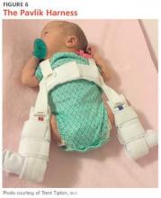 The Pavlik Harness image