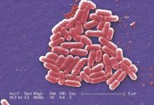 This colorized scanning electron micrograph depicts a number of Escherichia coli bacteria of the strain O157:H7. This strain of E. coli is an emerging cause of foodborne illness.