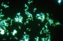 This image shows a positive fluorescent antibody test for the gram-negative bacterium Neisseria gonorrhoeae.