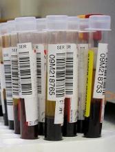 Blood samples Photo by Graham Colm