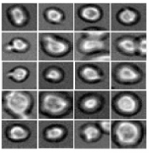 Cells with expressed markers for the megakaryocytic/ erythroid lineage Image courtesy of Helmholtz Zentrum München