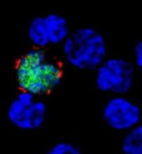 EBV-infected cell (green/red) among uninfected cells (blue) Image courtesy of Benjamin Chaigne-Delalande