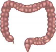 Illustration of intestine