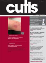 August Cutis Cover