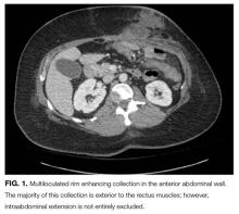 Multiloculated rim enhancing collection in the anterior abdominal wall