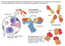 Monoclonal gammopathies