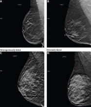 Breast density categories