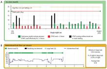  Figure 2. Download of positive airway pressure use data for a month (A) and leak data for a night (B). 