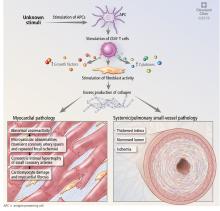 Mechanisms of cardiac and vascular involvement in systemic sclerosis