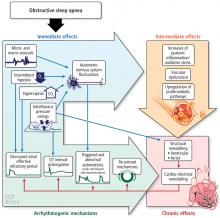 Figure 2. Pathophysiologic pathways of obstructive sleep apnea and cardiac arrhythmia.