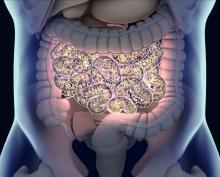 colon digital image demonstrating microbiome