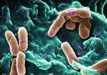 A number of Pseudomonas aeruginosa bacteria is shown.