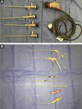 Figure 3. A: Standard 0°, 30°, 45°, and 70° angulated endoscopes used in endoscope-controlled microsurgery. B: Instruments specifically designed for endoscope-controlled microsurgery.