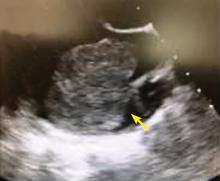 Figure 2. Transthoracic echocardiography.