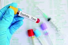 Vial labeled Syphilis Test