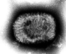 genetic material of smallpox, a variola virus