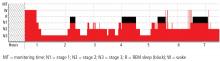 Figure 3. A hypnogram depicts the recorded levels of sleep over time.