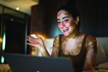 woman with vitiligo on video chat