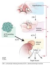 The hypothalamic-pituitary-adrenal axis