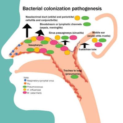 Profile of respiratory bacteria in children younger than 6 months ...