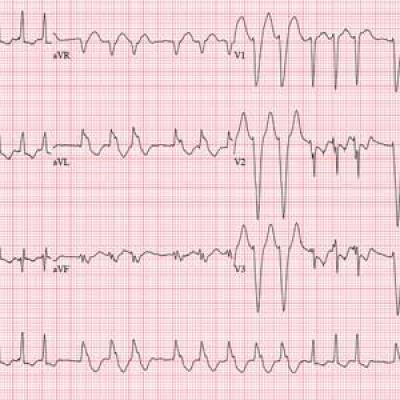 Enough Fuss; She Wants Lunch! | Clinician Reviews