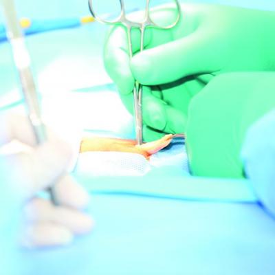 Botox smooths prep for hernia surgery | MDedge Surgery