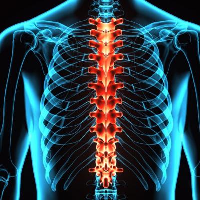 Spine fracture risk may be increased in IBD patients | GI and ...