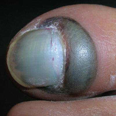 Two Toned Toes Clinician Reviews