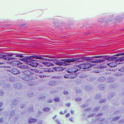 Red-Brown Patches in the Groin | MDedge Dermatology