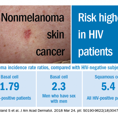 HIV infection linked to higher risk of non-melanoma skin cancer ...