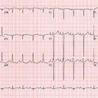 A Method to His Madness | Clinician Reviews