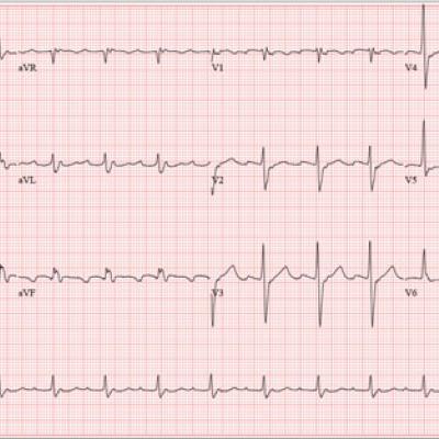 For Lethargic Patient, Trouble Is Brewing | Clinician Reviews