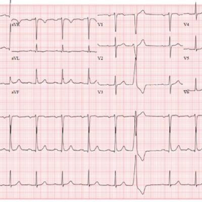 Man Gets Burning Sensation in Chest During an Argument | Clinician Reviews