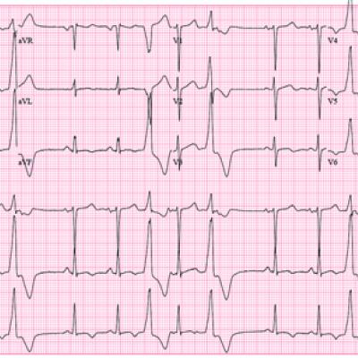 Woman with Metabolic Syndrome | Clinician Reviews