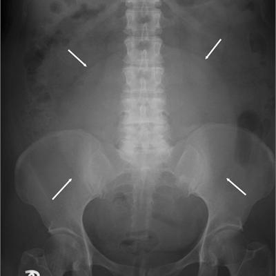 Large Pelvic Mass Mdedge Family Medicine