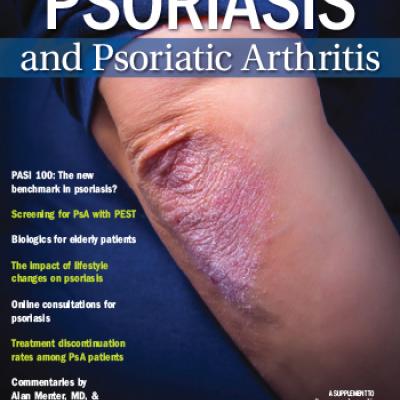 psoriasis treatment lifestyle