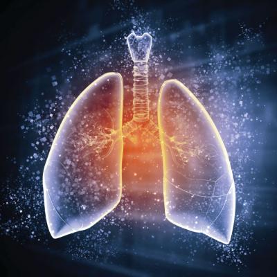 Updated IPF guideline refines diagnostic criteria with HRCT | CHEST ...