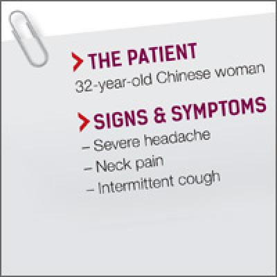 A Stiff Neck, High Fever, & Intense Headache Could Be Signs of