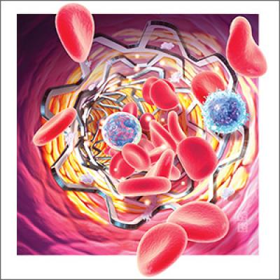 The art of delivering evidence-based dual antiplatelet therapy | MDedge ...