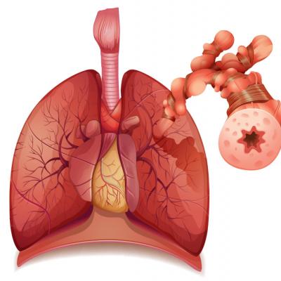 Asthma: Newer Tx options mean more targeted therapy | MDedge Family ...