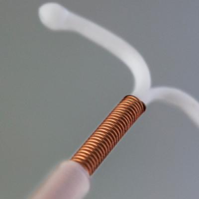 How Common Is IUD Perforation Expulsion And Malposition MDedge ObGyn   OBGM0340408 Editorial 570x300.JPG