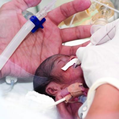 Heart surgery halves in-hospital mortality in trisomy 13 and 18 ...