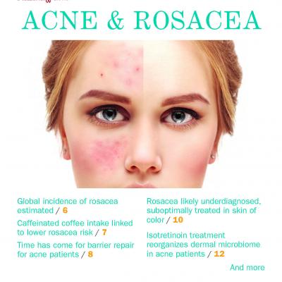 Acne and Rosacea - July 2019 Supplement | MDedge Dermatology