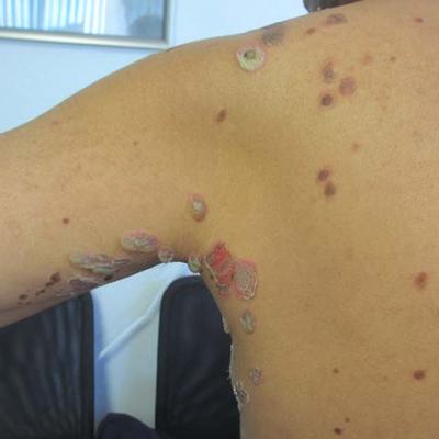Make the Diagnosis - January 2017 | MDedge Dermatology
