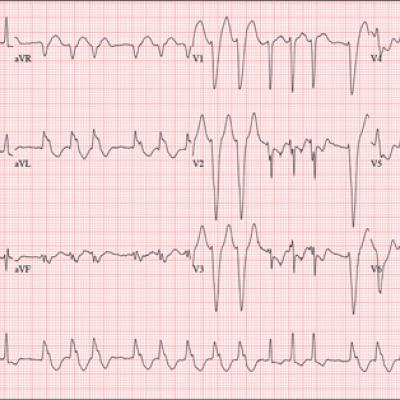 Interpretation: Humans, 1; Machine, 0 | Clinician Reviews