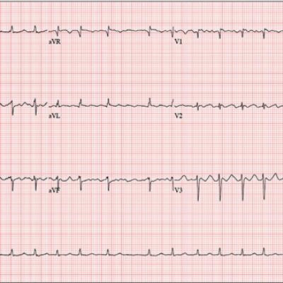 Friendly Advice Goes Awry | Clinician Reviews