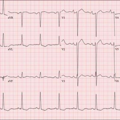 A Prescription for Trouble | Clinician Reviews