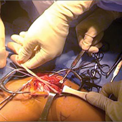 Ant sulfur Separation Using Wearable Technology to Record Surgical Videos | MDedge Surgery