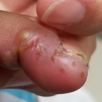 Can You Put Your Finger on the Diagnosis? | Clinician Reviews